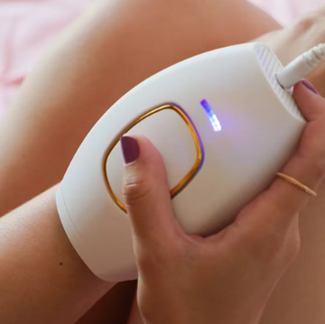 Laser hair removal