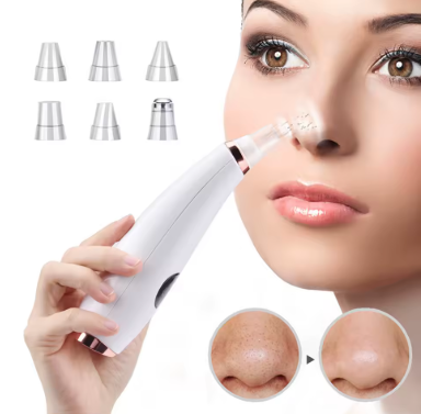 Electric Blackhead Remover